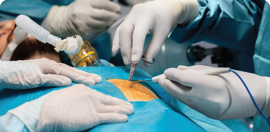 treatment image