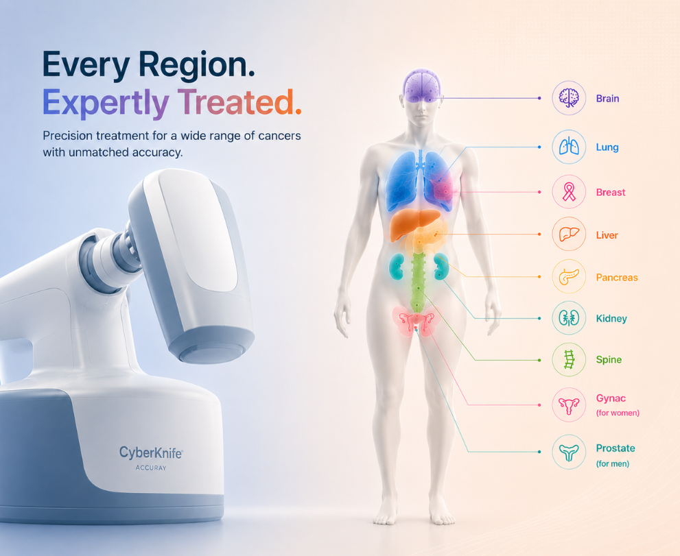 Cyberknife Section Mobile2