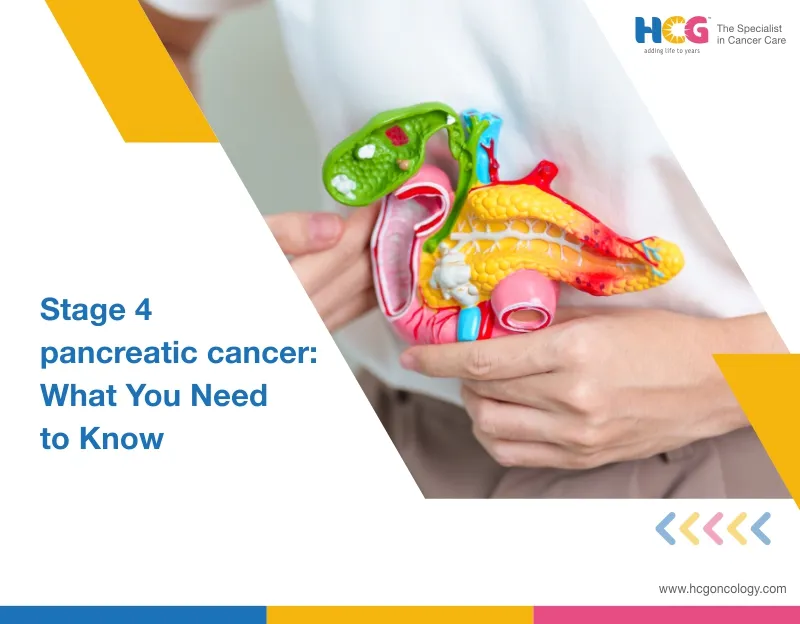 Stage 4 Pancreatic Cancer: What You Need To Know
