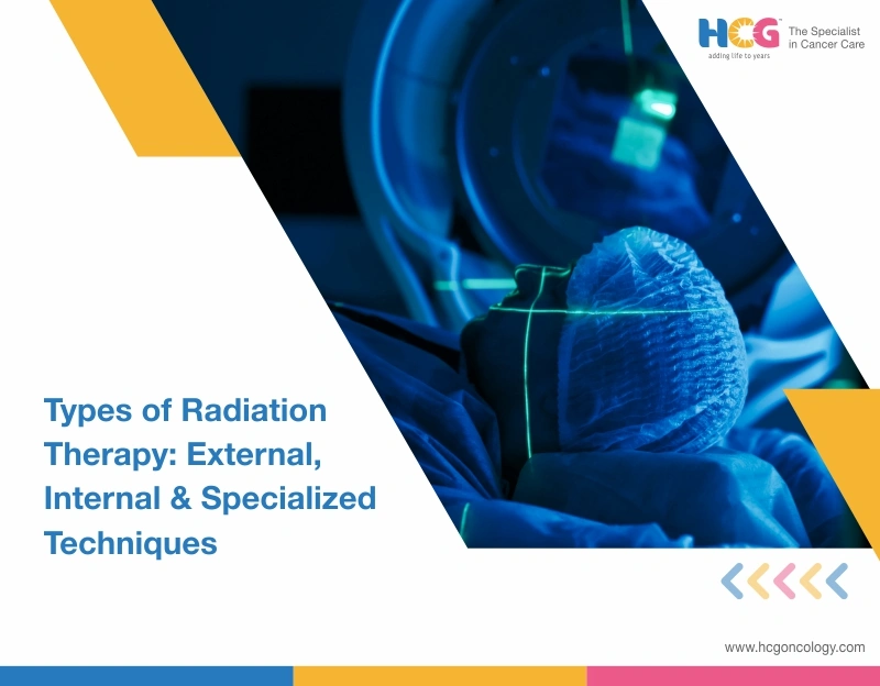 Types of Radiation Therapy: External, Internal & Specialized Techniques