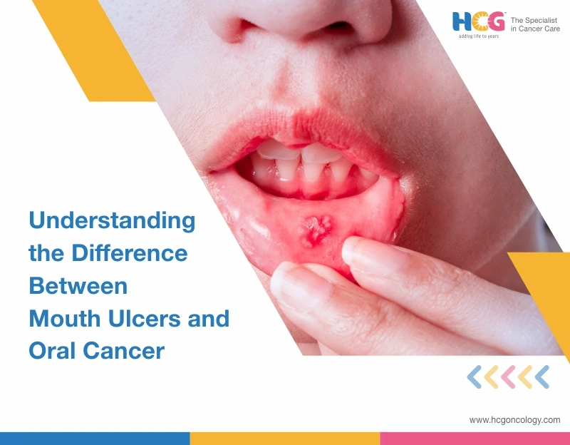 Mouth Ulcer vs Oral Cancer: Key Differences and Warning Signs