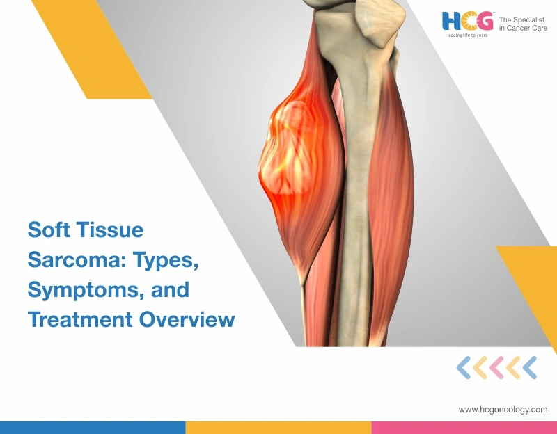 Soft Tissue Sarcoma: What It Is, How It’s Diagnosed, and How It’s Treated