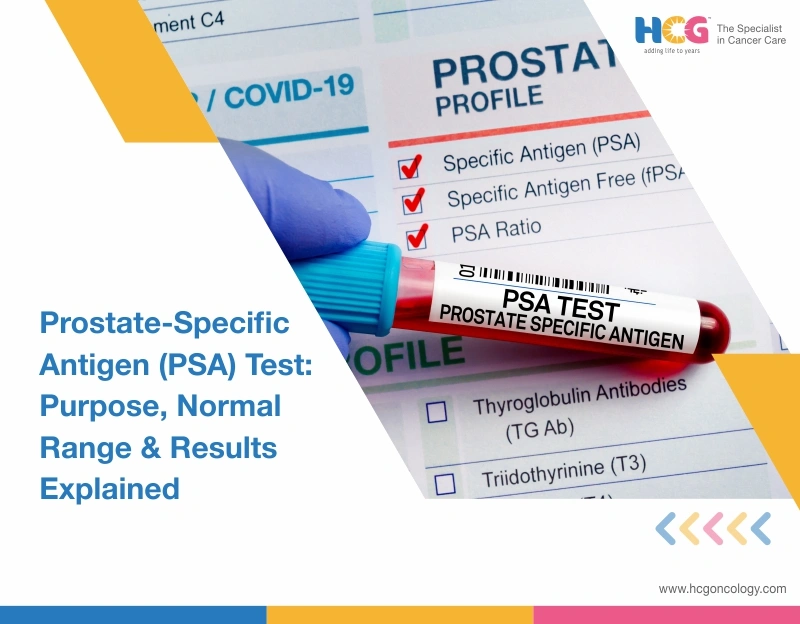 Prostate-Specific Antigen (PSA) Test: Purpose, Normal Range & Results Explained