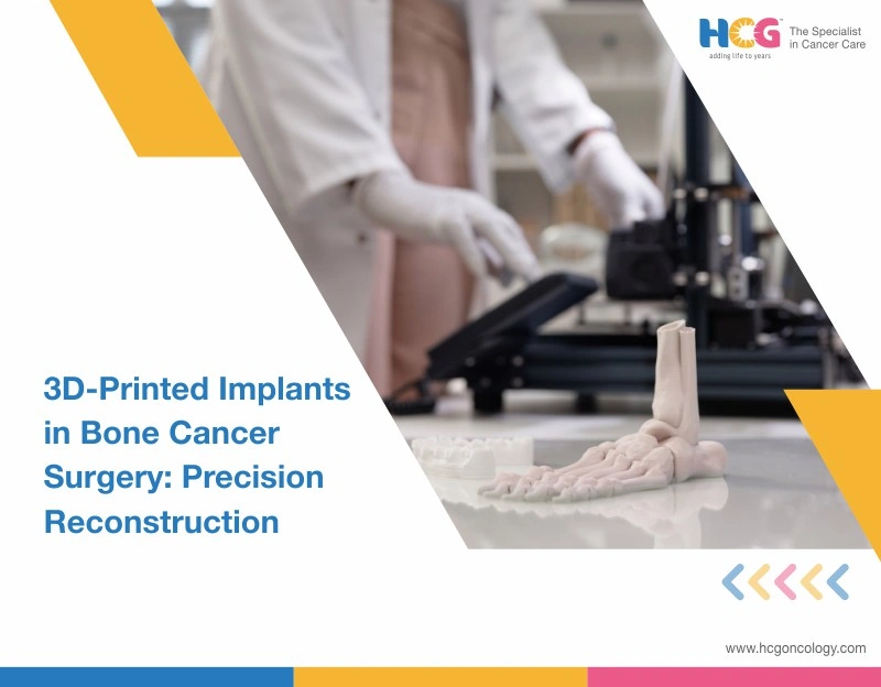 3D-Printed Implants in Bone Cancer Surgery: Precision Reconstruction