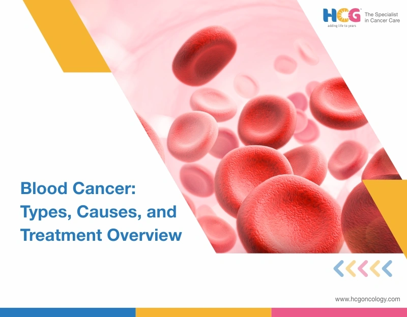 Blood Cancer: Types, Causes, and Treatment Overview
