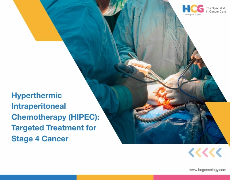 Hyperthermic Intraperitoneal Chemotherapy (HIPEC): Targeted Treatment for Stage 4 Cancer