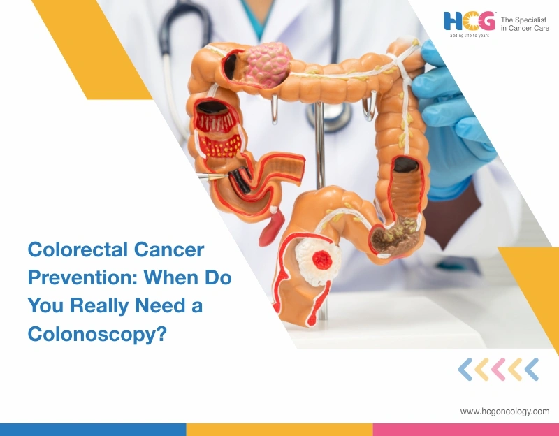 Colorectal Cancer Prevention: When Do You Really Need a Colonoscopy?