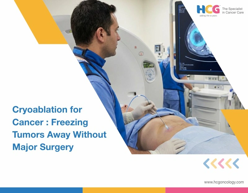 Cryoablation for Cancer: Freezing Tumors Away Without Major Surgery