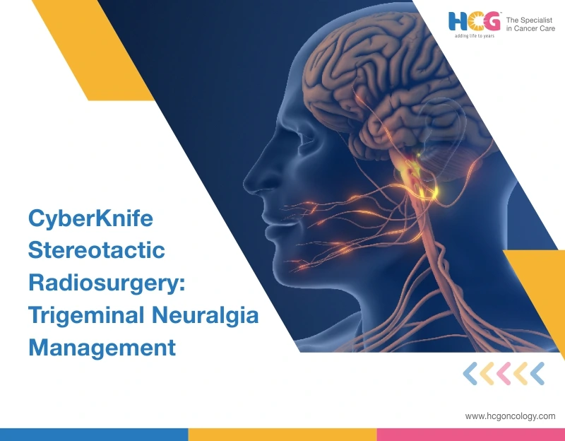 CyberKnife in Treating Trigeminal Neuralgia