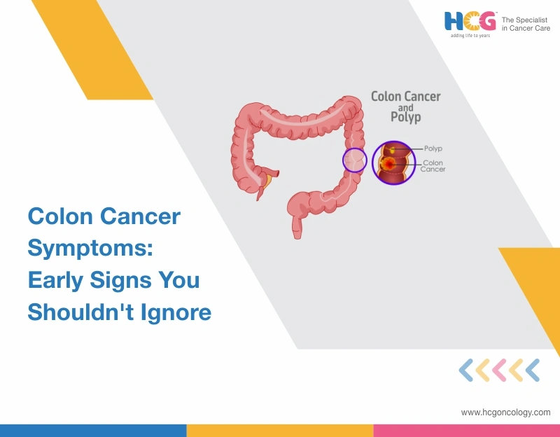 Colon Cancer Symptoms in Women: Early Warning Signs and When to Get Screened