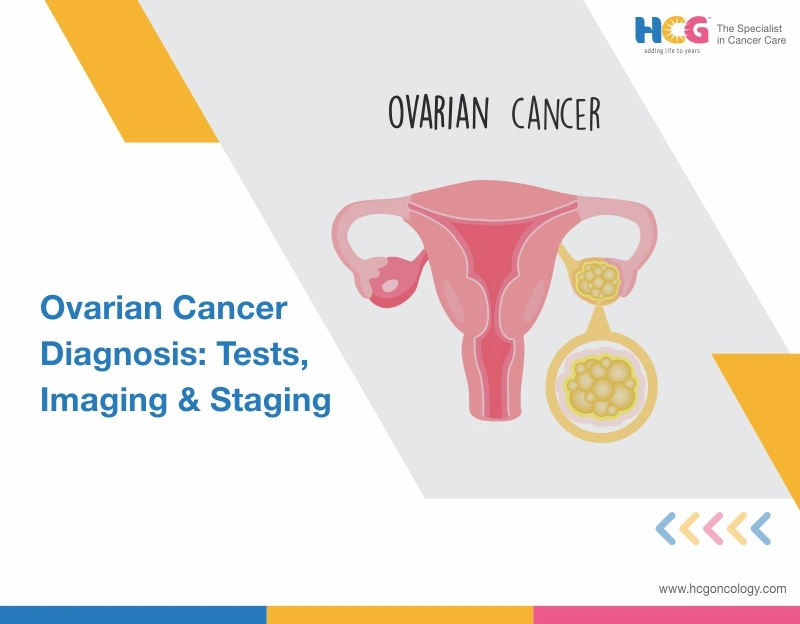 Ovarian Cancer Diagnosis: Tests, CA-125, Ultrasound & Biopsy