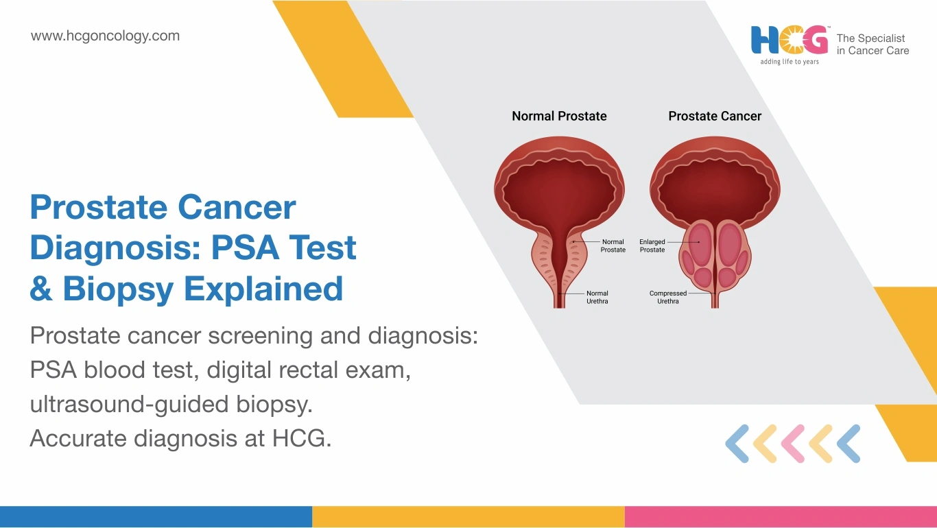 Prostate Cancer Diagnosis: PSA, MRI & Biopsy Tests