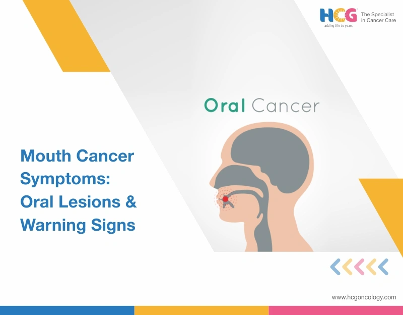Mouth Cancer Symptoms: Early Signs & Warning Changes