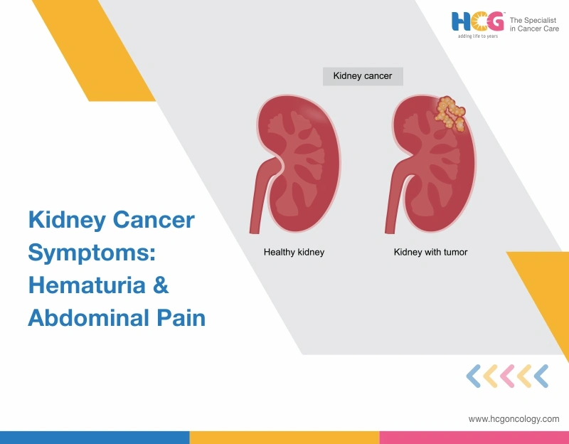 Kidney Cancer Symptoms: Early Signs & Warning Symptoms