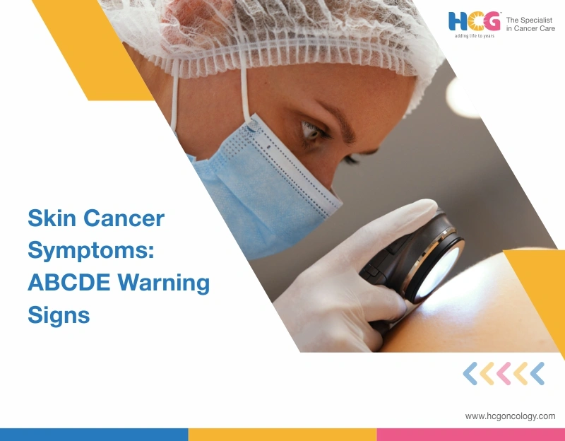 Early symptoms and warning signs of skin cancer