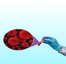 Hemato Oncology and Bone Marrow Transplant