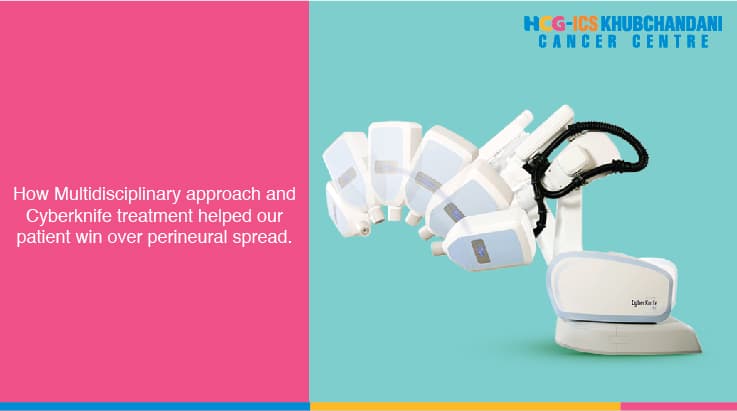 Cyberknife treatment for a particularly painful perineural spread
