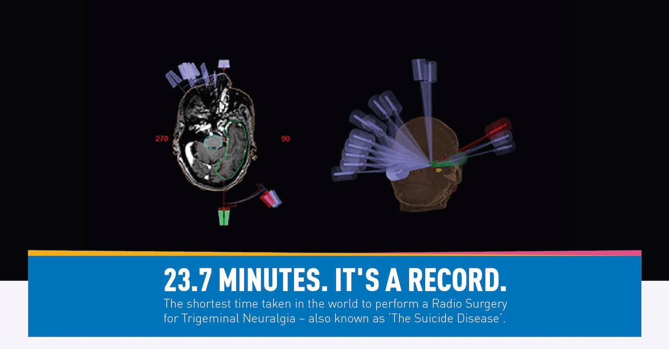 Expertise and Radio Surgery at HCG Cancer Centre, Mumbai, helps a Trigeminal Neuralgia patient achieve success in record time.