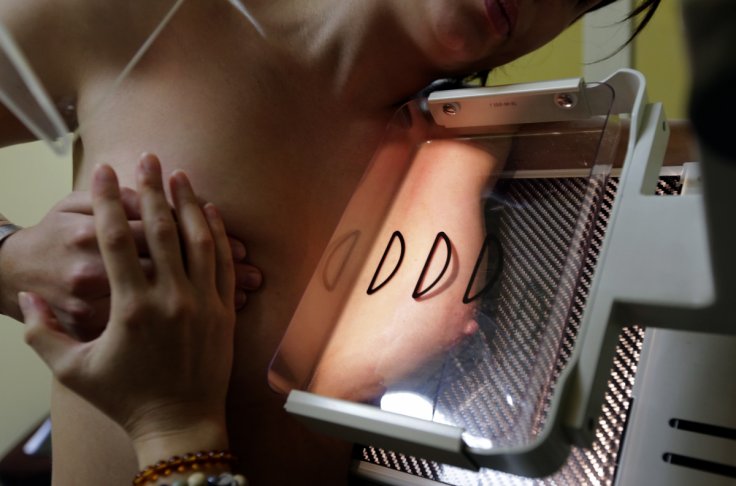 Getting pregnant is very much safer for breast cancer survivors, says study
