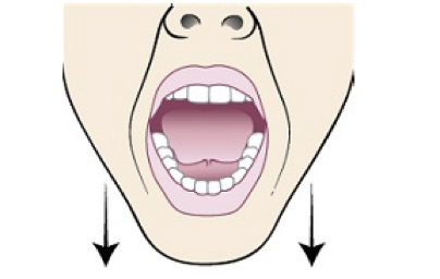 Streatch Mouth