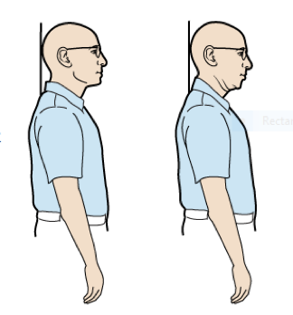 Chin tucks