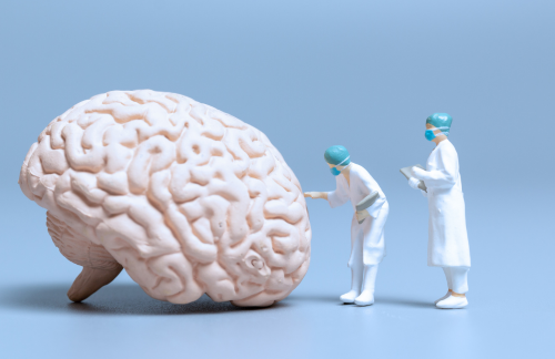 Glioblastoma Tumor: A Detailed Overview