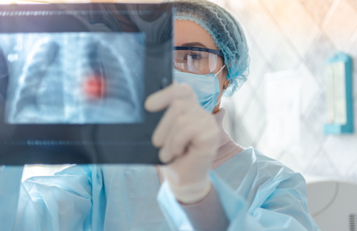 Advances in Diagnosing Lung Cancer Detection Techniques and the Impact of AI