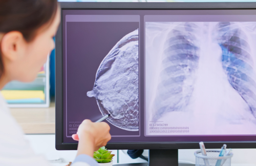 Mammogram Procedure : What is Mammogram, Purpose & it's Types